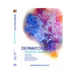 Dermatoscopia Aspecte Esentiale - Robert H. Johr H. Peter Soyer Giuseppe Argentiano Rainer Hofmann Wellenhof Massimiliano Scalvenzi