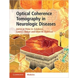 Optical Coherence Tomography in Neurologic Diseases - Peter A. Calabresi, Laura J. Balcer, Elliot M. Frohman